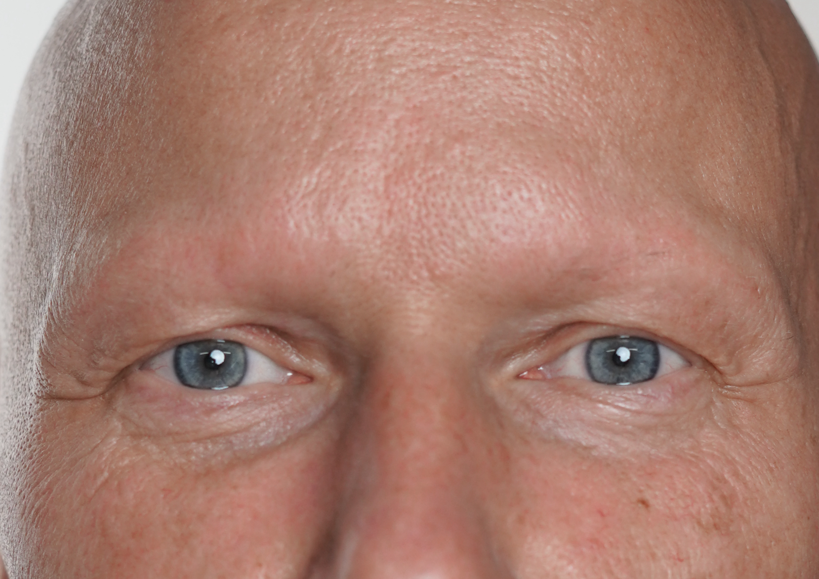 Meelis before